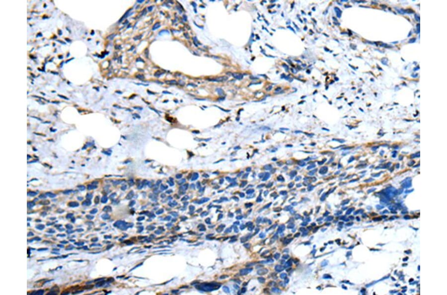 ZNF277 Antibody from Signalway Antibody (43577) - Antibodies.com