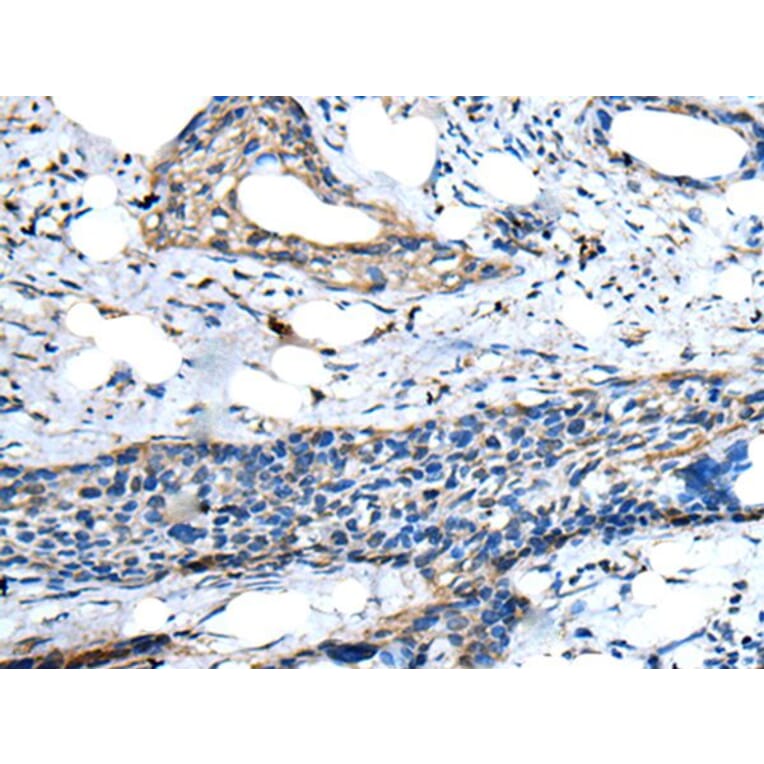 ZNF277 Antibody from Signalway Antibody (43577) - Antibodies.com