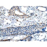 ZNF277 Antibody from Signalway Antibody (43577) - Antibodies.com