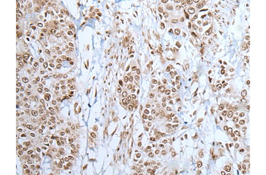 ZNF302 Antibody from Signalway Antibody (43578) - Antibodies.com