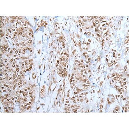 ZNF302 Antibody from Signalway Antibody (43578) - Antibodies.com