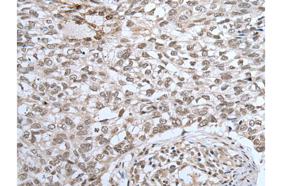 ZNF37A Antibody from Signalway Antibody (43581) - Antibodies.com