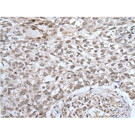 ZNF37A Antibody from Signalway Antibody (43581) - Antibodies.com