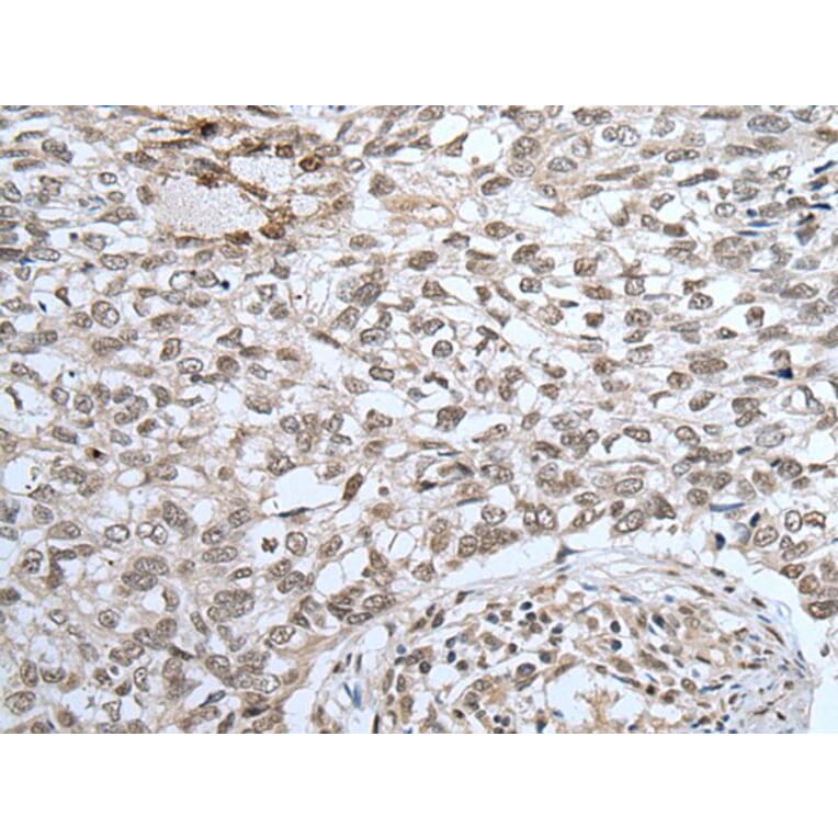 ZNF37A Antibody from Signalway Antibody (43581) - Antibodies.com