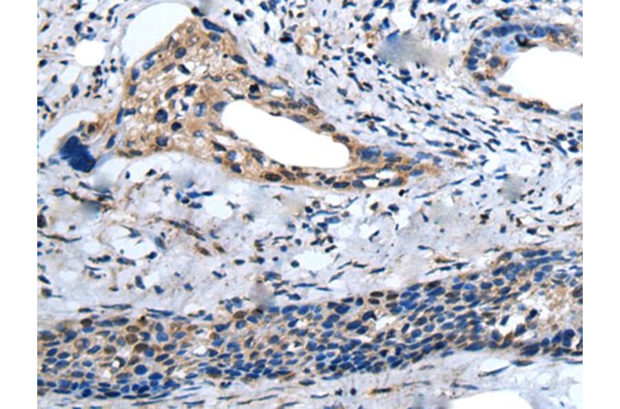 ZNF37A Antibody from Signalway Antibody (43581) - Antibodies.com