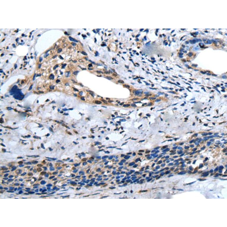 ZNF37A Antibody from Signalway Antibody (43581) - Antibodies.com