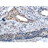 ZNF37A Antibody from Signalway Antibody (43581) - Antibodies.com