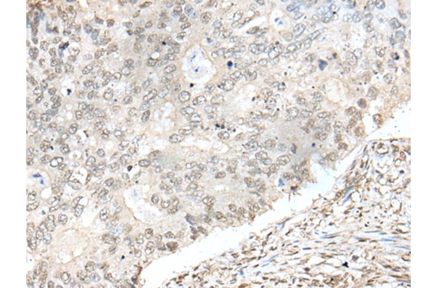 ZNF512 Antibody from Signalway Antibody (43582) - Antibodies.com