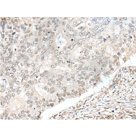 ZNF512 Antibody from Signalway Antibody (43582) - Antibodies.com