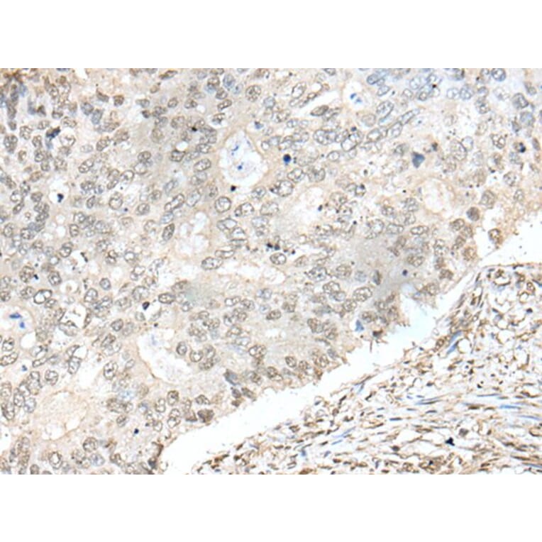 ZNF512 Antibody from Signalway Antibody (43582) - Antibodies.com