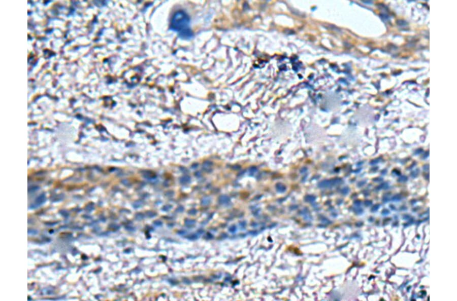 ZNF512 Antibody from Signalway Antibody (43582) - Antibodies.com
