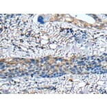 ZNF512 Antibody from Signalway Antibody (43582) - Antibodies.com