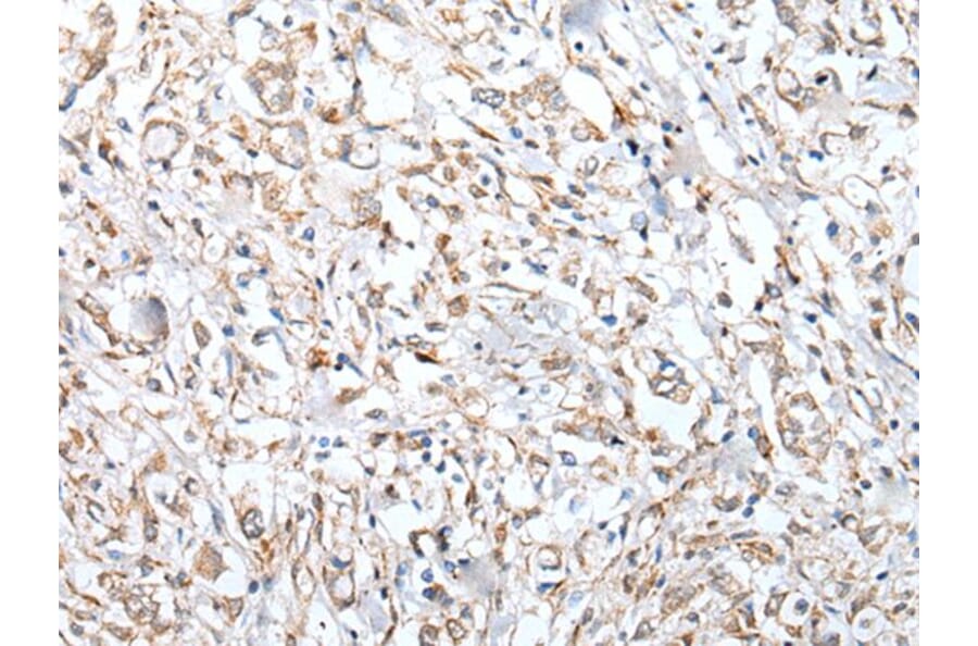 VPREB3 Antibody from Signalway Antibody (43594) - Antibodies.com
