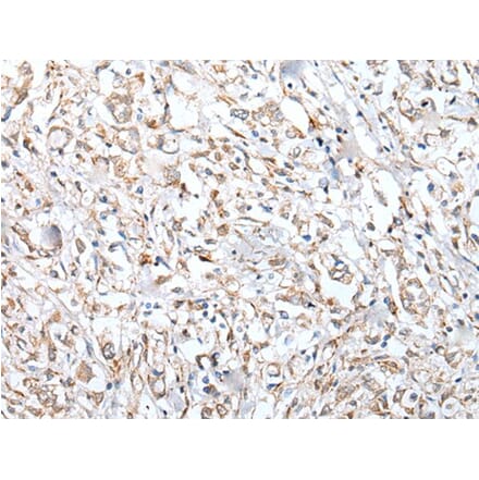 VPREB3 Antibody from Signalway Antibody (43594) - Antibodies.com