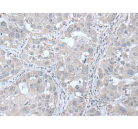 UBE2Q2 Antibody from Signalway Antibody (43600) - Antibodies.com