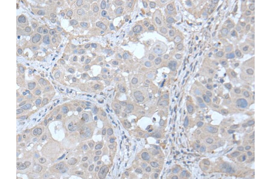 UBE2Q2 Antibody from Signalway Antibody (43600) - Antibodies.com