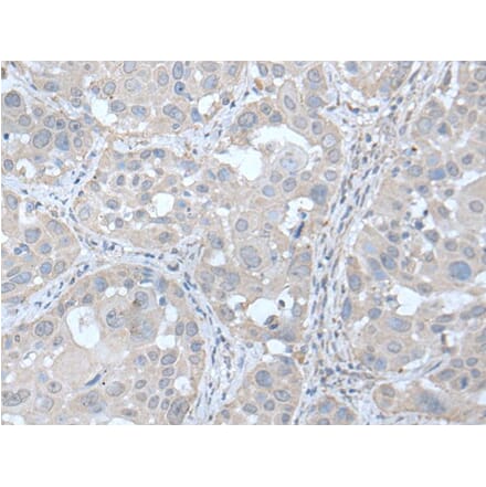 UBE2Q2 Antibody from Signalway Antibody (43600) - Antibodies.com