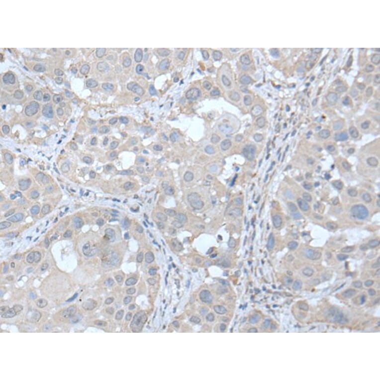 UBE2Q2 Antibody from Signalway Antibody (43600) - Antibodies.com