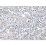 UBE2Q2 Antibody from Signalway Antibody (43600) - Antibodies.com