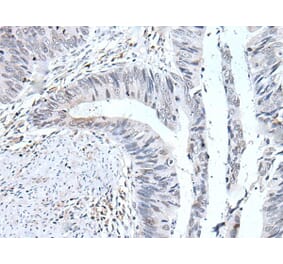 UBE2T Antibody from Signalway Antibody (43604) - Antibodies.com