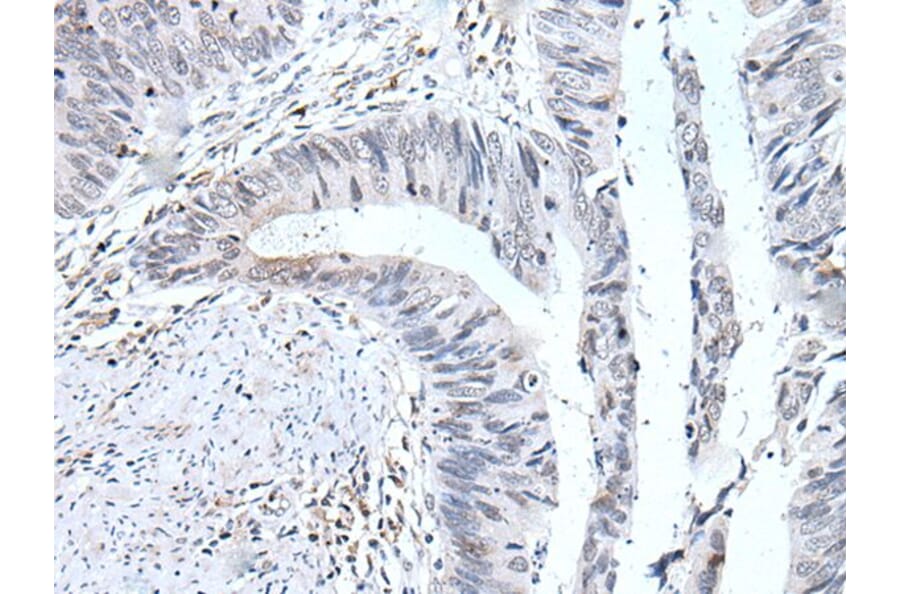 UBE2T Antibody from Signalway Antibody (43604) - Antibodies.com