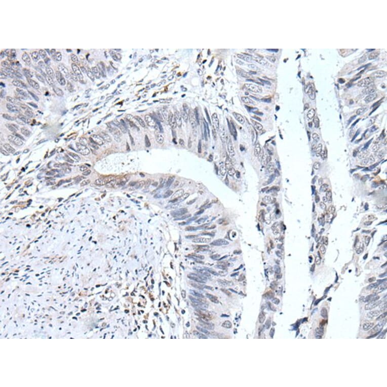 UBE2T Antibody from Signalway Antibody (43604) - Antibodies.com