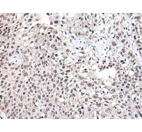 UBE2E3 Antibody from Signalway Antibody (43605) - Antibodies.com