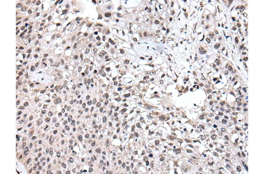 UBE2E3 Antibody from Signalway Antibody (43605) - Antibodies.com