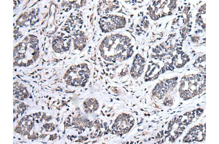 UBE2E3 Antibody from Signalway Antibody (43605) - Antibodies.com