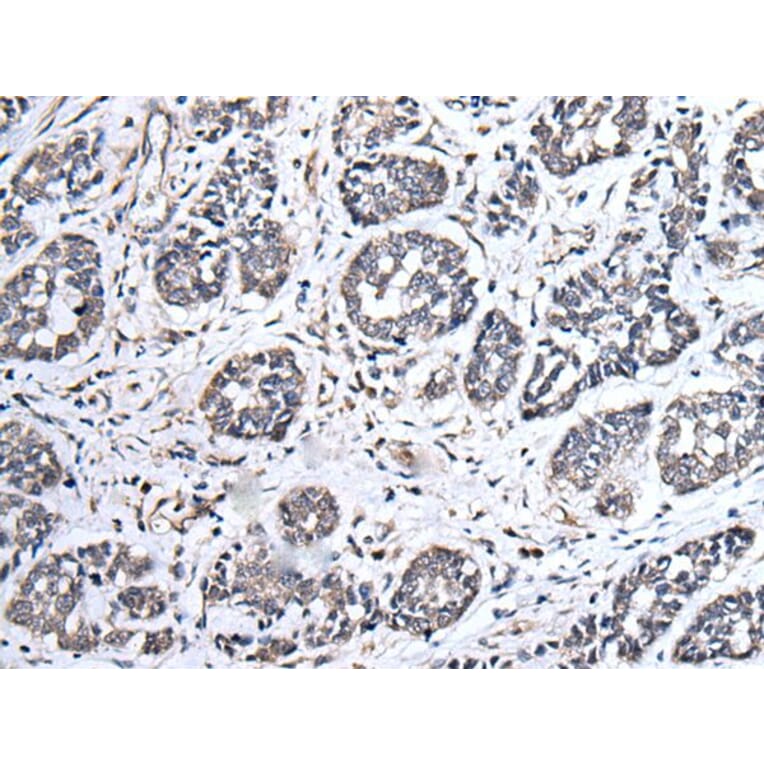 UBE2E3 Antibody from Signalway Antibody (43605) - Antibodies.com