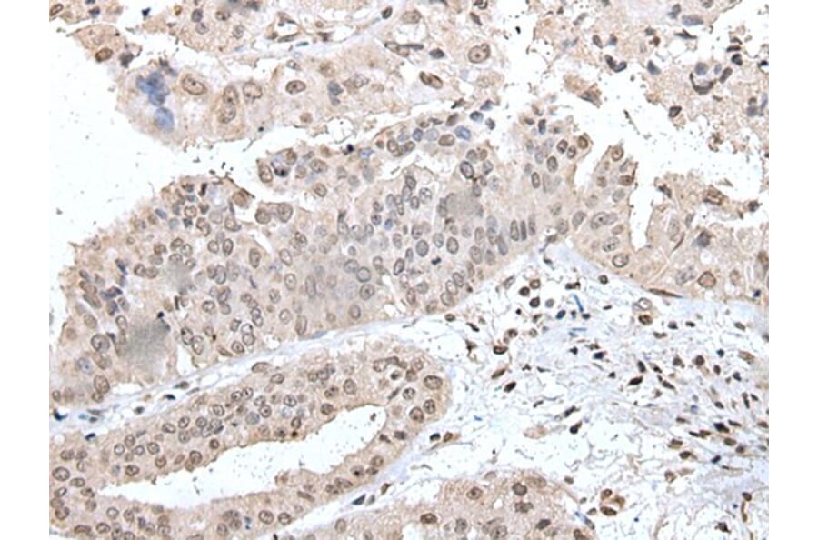 UBE2E2 Antibody from Signalway Antibody (43608) - Antibodies.com