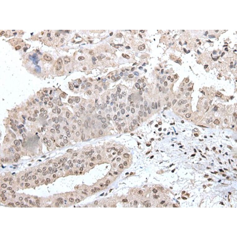 UBE2E2 Antibody from Signalway Antibody (43608) - Antibodies.com