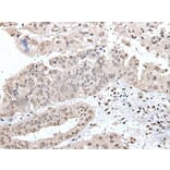 UBE2E2 Antibody from Signalway Antibody (43608) - Antibodies.com