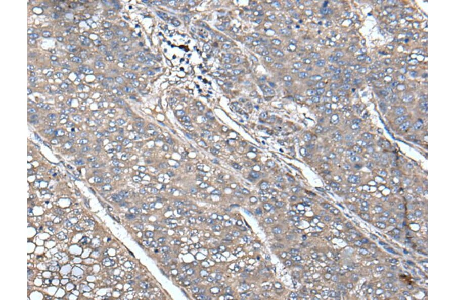 UNC13B Antibody from Signalway Antibody (43616) - Antibodies.com