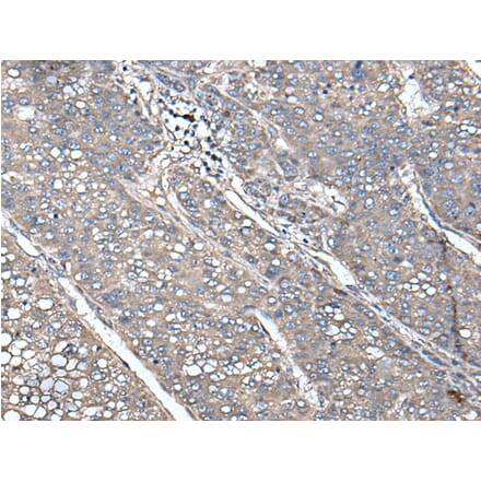 UNC13B Antibody from Signalway Antibody (43616) - Antibodies.com