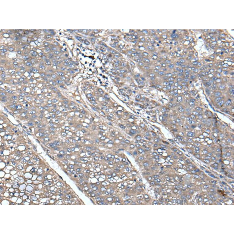 UNC13B Antibody from Signalway Antibody (43616) - Antibodies.com
