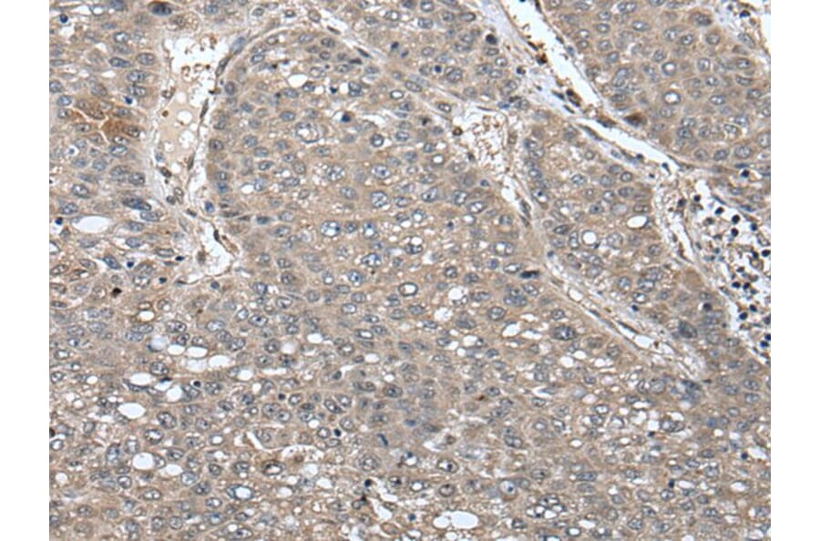 UNC45B Antibody from Signalway Antibody (43617) - Antibodies.com