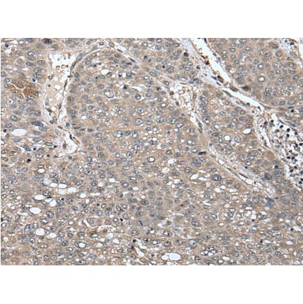 UNC45B Antibody from Signalway Antibody (43617) - Antibodies.com