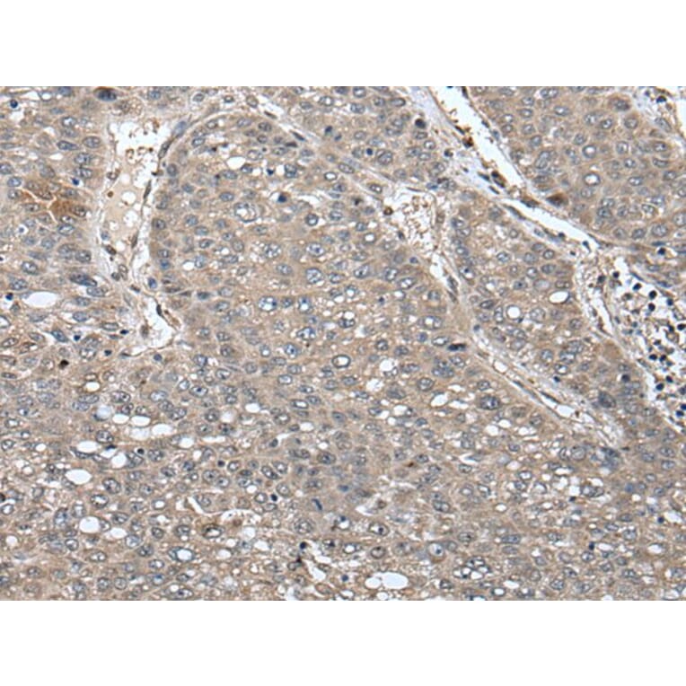 UNC45B Antibody from Signalway Antibody (43617) - Antibodies.com