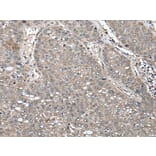 UNC45B Antibody from Signalway Antibody (43617) - Antibodies.com