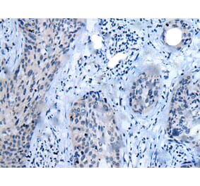 CLDN18 Antibody from Signalway Antibody (43625) - Antibodies.com