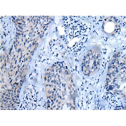CLDN18 Antibody from Signalway Antibody (43625) - Antibodies.com