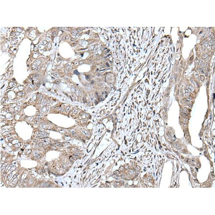 RAD54B Antibody from Signalway Antibody (43630) - Antibodies.com