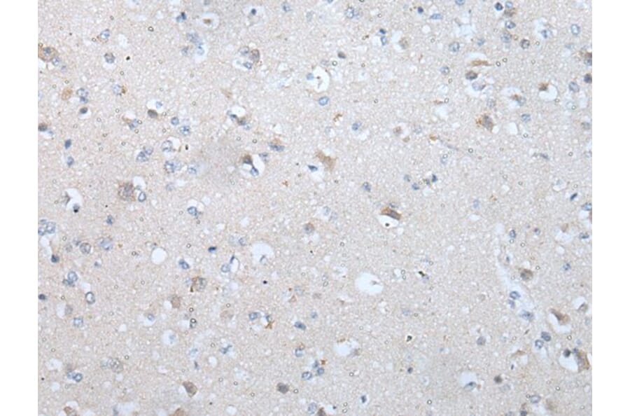 TM9SF1 Antibody from Signalway Antibody (43640) - Antibodies.com