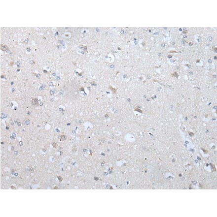 TM9SF1 Antibody from Signalway Antibody (43640) - Antibodies.com