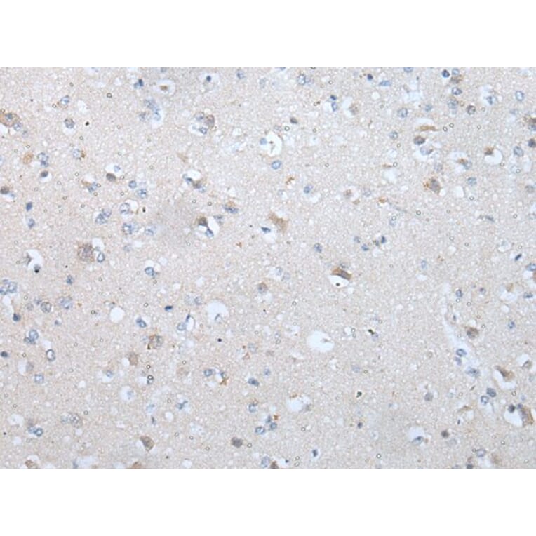 TM9SF1 Antibody from Signalway Antibody (43640) - Antibodies.com