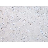 TM9SF1 Antibody from Signalway Antibody (43640) - Antibodies.com