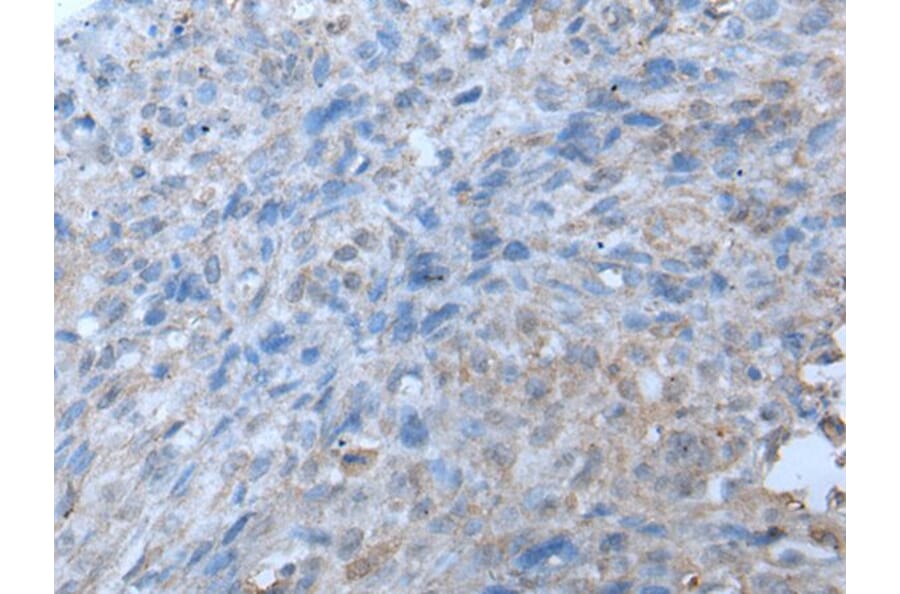 TRIP11 Antibody from Signalway Antibody (43642) - Antibodies.com