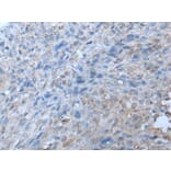 TRIP11 Antibody from Signalway Antibody (43642) - Antibodies.com