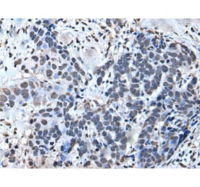 GTF2H1 Antibody from Signalway Antibody (43644) - Antibodies.com